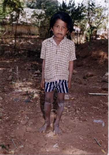C.SELVARAJ - INDIA