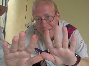 Ha ancora le mani sporche del sangue del riccio